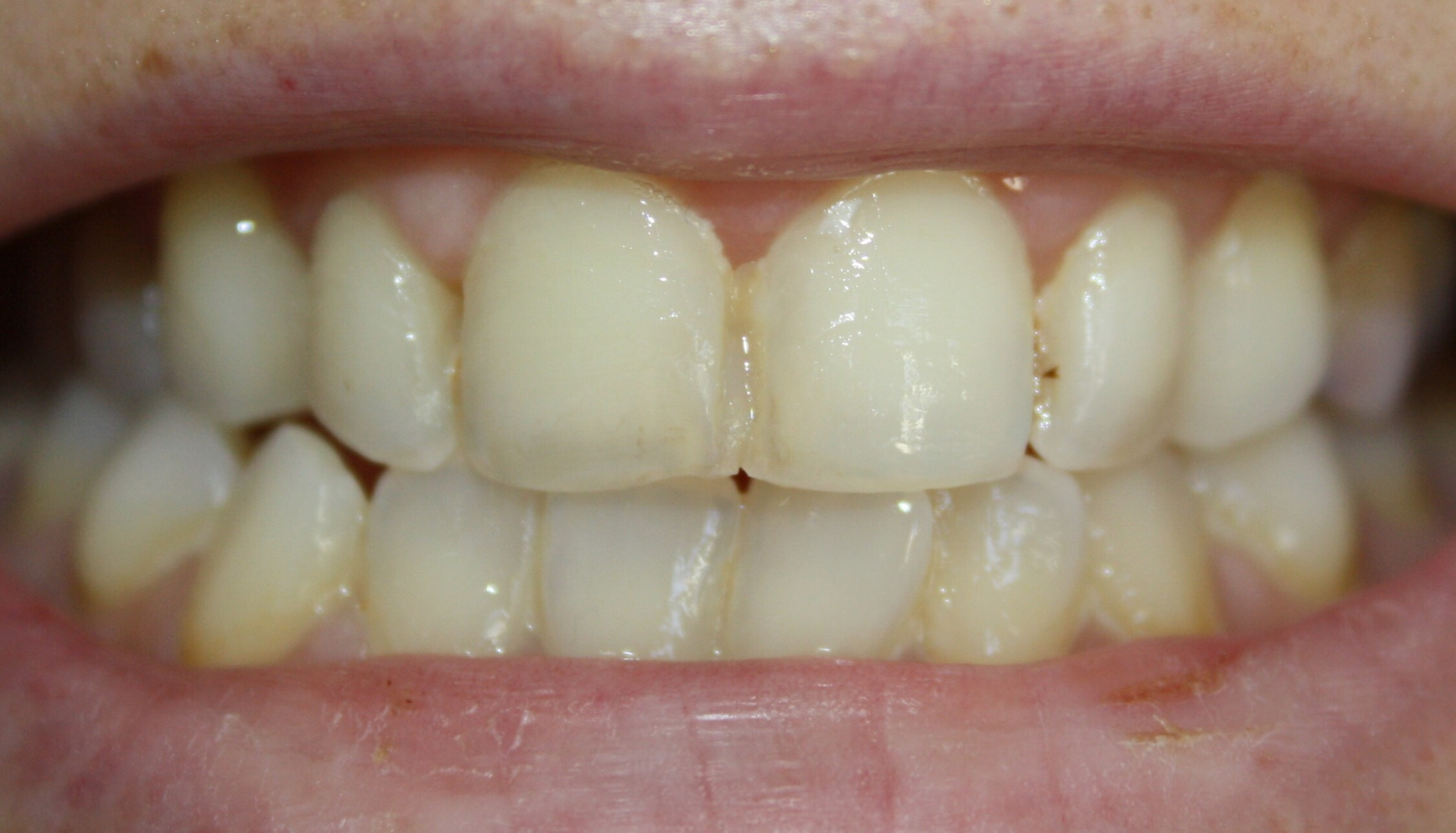 igiene1